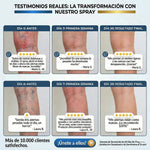 ✨ SPRAY VARICES CRIOTERAPIA ULTRA™ 2x1 | Alivio y Cuidado para las Várices 🦵🛡️