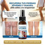 ✨ SPRAY VARICES CRIOTERAPIA ULTRA™ 2x1 | Alivio y Cuidado para las Várices 🦵🛡️