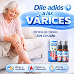 ✨ SPRAY VARICES CRIOTERAPIA ULTRA™ 2x1 | Alivio y Cuidado para las Várices 🦵🛡️
